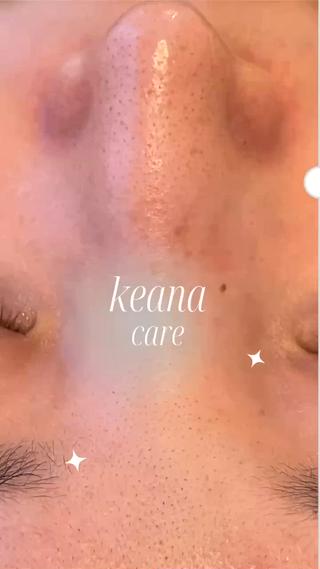 毛穴をとことん綺麗にしたいあたなへ 