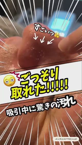 【メンズエステ ルースは男性の為の男性が行うサロン】
メンズニキビ、肌荒れ、毛穴ケア、シミ、たるみ、眉毛、シワのお悩み気軽にご相談ください！https://luz-salon.com/
【肌相談】https://luz-salon.com/reserve/

毛穴の気になる黒ずみ...
毛穴に詰まった皮脂汚れ...

ハイドロスプラッシュの
トルネード水流で
溜まりに溜まった古い角質
毛穴の皮脂汚れを
まるっと大掃除

アフターケアも充実！
施術後の自分の汚れに
驚きます(汗;)

興味がある方
【毛穴ケア・黒ずみ撃退エステ】
一度お試し下さい。

本気でお肌にお悩みの方必見★

【学割エステ4,950円/7,700円】の2コースをご用意！
年齢特有の思春期ニキビ・毛穴の黒ずみ・肌悩みに対応出来るようにプログラムを組み、学生でも受けやすい金額で特別メニューを設定いたしました。ニキビ跡にならないケア方法をしっかり行い後悔しない肌ケアしましょう！

★★メンズニキビ・肌トラブル回復メンズエステ★★
女性にとって今やエステやスキンケアは当たり前ですが、実際には男性の方が肌トラブルを抱えているケースが多くあります。それは女性より、【皮脂の分泌量は3倍以上】【水分量は半分以下】【毛穴は大きい】という特徴があるためです。
肌トラブルは放置しておくと悪化してしまったり、老化を早めることに繋がったりしますので、気になる場合は是非ご相談ください。

★★メンズ毛穴ケア・黒ずみ撃退エステ★★
男性の毛穴が目立つ原因は「皮脂分泌量の多さ」です。本来は乾燥から肌を守る役割がある皮脂ですが、多すぎると毛穴を広げる要因に。また、毛穴の中で皮脂と汚れが混ざると角栓や黒ずみになってしまいます。毛穴ケアには欠かせない【クレイでの泡パック】【酵素パック】【水の力で保湿】のトリプルの力でしつこいメンズの毛穴汚れを撃退します
https://luz-salon.com/menu/pore-care/

★★メンズシミ取りエステ★★
ミは性別を問わず中年以降の男女にできます。男性の方がシミが出来やすく・濃くなりやすい特徴があります。それの原因には【7割の男性がスキンケアをしていない】【日焼け止めをしていない】こういった事が原因と言われています。


★★メンズアンチエイジングエステ★★
【老化現象に性別は関係ありません】筋力の弱化、肌のトラブル、疲れやすさ、たるみ、シワ、乾燥と多岐にわたるメンズの肌老化に対応いたします。 