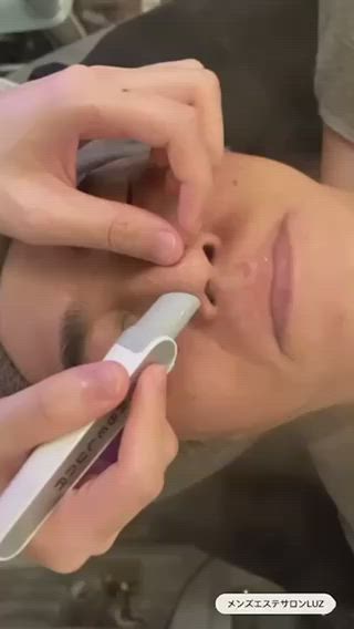 【メンズの毛穴】ニキビやニキビ跡に次ぐ肌悩みNO,3に入る毛穴の黒ずみ・詰まり解消エステ　川口市メンズエステサロン　ルース

【メンズエステ ルースは男性の為の男性が行うサロン】
メンズニキビ、肌荒れ、毛穴ケア、シミ、たるみ、眉毛、シワのお悩み気軽にご相談ください！https://luz-salon.com/
【肌相談】https://luz-salon.com/reserve/

【学割エステ4,950円/7,700円】の2コースをご用意！
年齢特有の思春期ニキビ・毛穴の黒ずみ・肌悩みに対応出来るようにプログラムを組み、学生でも受けやすい金額で特別メニューを設定いたしました。ニキビ跡にならないケア方法をしっかり行い後悔しない肌ケアしましょう！

★★メンズニキビ・肌トラブル回復メンズエステ★★
女性にとって今やエステやスキンケアは当たり前ですが、実際には男性の方が肌トラブルを抱えているケースが多くあります。それは女性より、【皮脂の分泌量は3倍以上】【水分量は半分以下】【毛穴は大きい】という特徴があるためです。
肌トラブルは放置しておくと悪化してしまったり、老化を早めることに繋がったりしますので、気になる場合は是非ご相談ください。

★★メンズ毛穴ケア・黒ずみ撃退エステ★★
男性の毛穴が目立つ原因は「皮脂分泌量の多さ」です。本来は乾燥から肌を守る役割がある皮脂ですが、多すぎると毛穴を広げる要因に。また、毛穴の中で皮脂と汚れが混ざると角栓や黒ずみになってしまいます。毛穴ケアには欠かせない【クレイでの泡パック】【酵素パック】【水の力で保湿】のトリプルの力でしつこいメンズの毛穴汚れを撃退します
https://luz-salon.com/menu/pore-care/

★★メンズシミ取りエステ★★
ミは性別を問わず中年以降の男女にできます。男性の方がシミが出来やすく・濃くなりやすい特徴があります。それの原因には【7割の男性がスキンケアをしていない】【日焼け止めをしていない】こういった事が原因と言われています。


★★メンズアンチエイジングエステ★★
【老化現象に性別は関係ありません】筋力の弱化、肌のトラブル、疲れやすさ、たるみ、シワ、乾燥と多岐にわたるメンズの肌老化に対応いたします。 