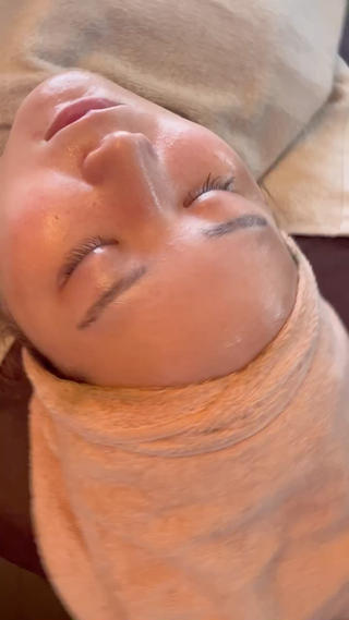 剥離なし
ダウンタイムなし

陶肌トリートメント（ハーブピーリング）


施術後のお肌です1回目にて


お肌つやつや

たま肌プルプルです 