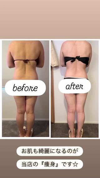 本気で痩せたい方へ 痩身専門サロンのエステ・リラクイメージ