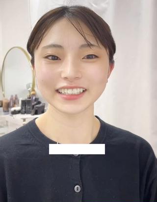 A Iの肌分析結果に合わせたパーソナルエステ初体験
シミ、乾燥でお悩みのM様、1回で【透明感】【うるおい】【毛穴レス】高実感に喜びの笑顔いっぱい 
