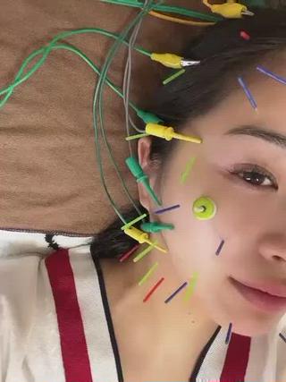 美容鍼＋EMS

表参道より徒歩２分
表参道鍼灸サロンmahoroba福田です。
美容鍼を他院で行ったけれどもあまり効果を感じられなかった方、整形級の引き上げを体感したい方！是非一度お試し下さい。
＃表参道美容鍼
＃表参道小顔
＃たるみ改善
＃リフトアップ
＃アンチエイジング
＃小顔 