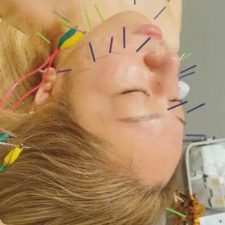 美容鍼灸サロン mahoroba院長のエステ・リラクイメージ