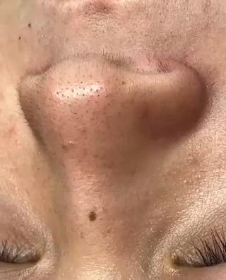 全顔wax通常¥12000→ミニモ初回限定価格¥4000
（2回目以降も特別割引価格ご用意してます♪）

waxは産毛はもちろんのこと皮脂汚れや角栓など目に見えて違いを実感できるメニューです！使用後のwaxを見てみなさん驚かれます
ツルピカ肌を是非一度ご体験下さい 