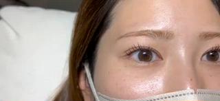 ラッシュリフト 