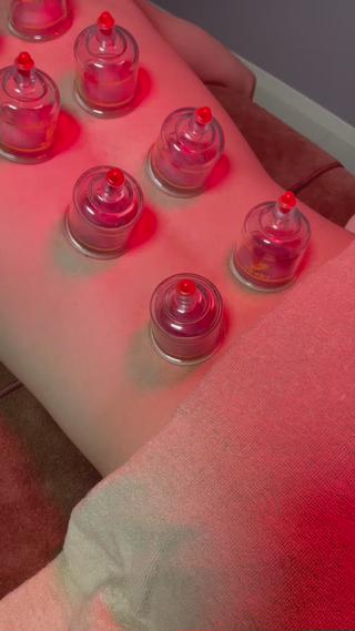 〜吸い玉〜

カップを皮膚に密着させ、陰圧（引く力）を利用し、血液の滞りを吸引し、血液循環の改善を図る治療法です。筋肉にも刺激を与えることで血液の循環を良くすることができます。
痛みもなくスッキリとした感覚を味わっていただけます

・単発30分 ¥3000 
・コース併用時10分 ¥1000

ぜひお試しください！ 