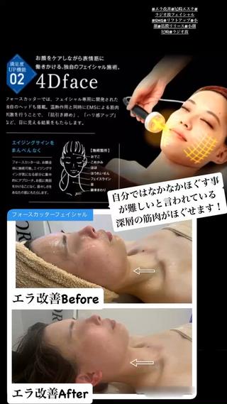 お顔の浮腫み、老廃物のつまり、表情筋のたるみ、（マリオネット、ほうれい線）や食いしばり、エラ張さんにオススメ！

首肩デコルテまでほぐすため、お顔の血流が良くなり、くすみが取れます！ 