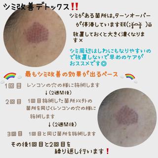 ヴィーナス ビューティーのエステ・リラクイメージ