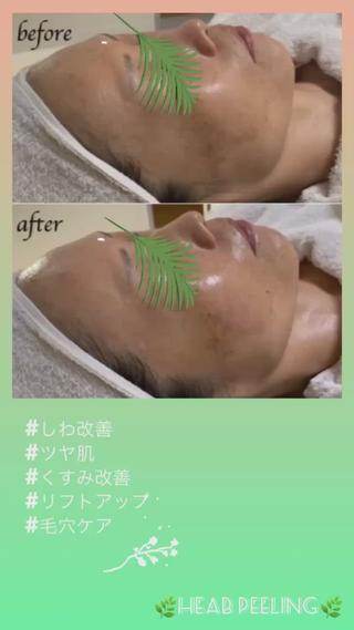 ヴィーナス ビューティーのエステ・リラクイメージ