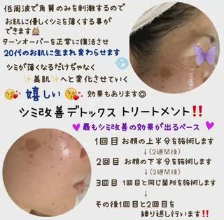 シミがお顔全体にある方に 