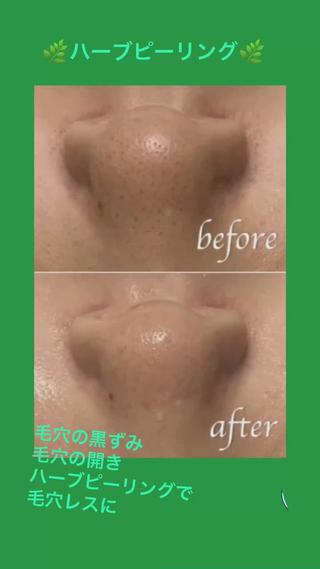 ヴィーナス ビューティーのエステ・リラクイメージ