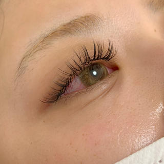 バインドロック100本 