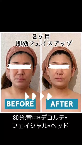 体験は¥5500 80分
2ヶ月で劇的たるみ・むくみ改善
久々の数年前の自分の顔に
モニターコースは定価より20%オフ料金
　　　　　8回1クール
ほうれい線・フェイスラインを引き上げ
あごりもスッキリ
体験後驚く方ばかり 


背中からしっかりリンパを流して筋肉緩和
　　　　　　↓
デコルテ・首リンパゆっくり丁寧に流してほぐす
　　　　　　↓
フェイシャルむくみ取りリンパマッサージ
　　　　　　↓
　　　　特殊顔筋マッサージ
　　　　　　↓
　　　　ヘッドマッサージ

満足感たっぷり
 