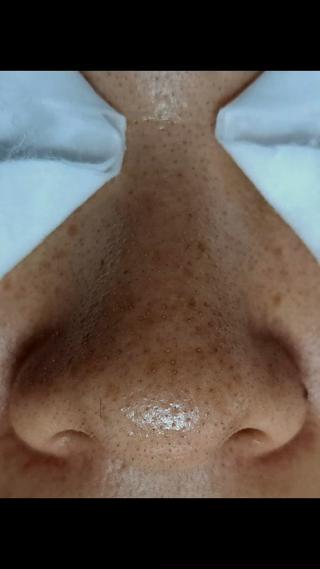 美肌脱毛サロン つるりと御殿場店所属・美肌脱毛サロン つるりとのその他イメージ