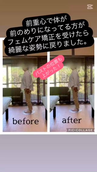 数名のフェムケア矯正を受けられた方のビフォー／アフターです。
姿勢が変わるだけで、見た目年齢が若返ると思いませんか？ 