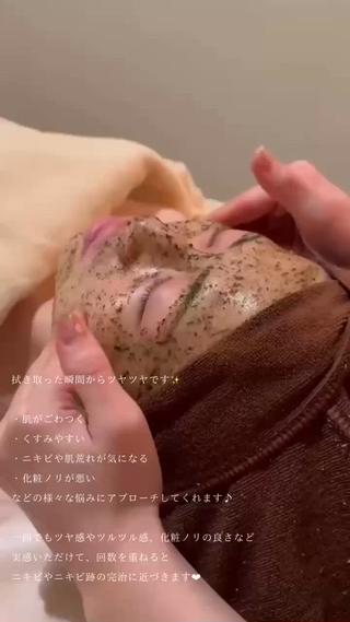 ダウンタイムも無いので大事な予定の前の日にもピッタリ‎ 