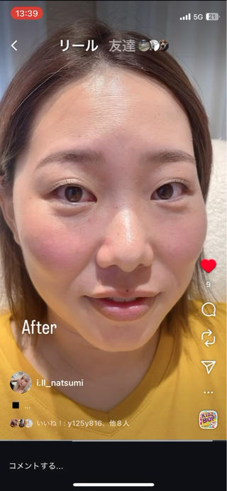 美眉wax＋ラッシュリフト
ぱっちりとは上げたいけど
一重でまつ毛がまぶたに当たりたくない
根本は立ち上げながらも少しの奥行きでお悩み解消
人それぞれの目元やお悩みを聞き出しロッド選定が重要です
同時施術の眉waxでスッキリ眉
デザインもしっかりカウンセリングさせていただきます。
２時間で目元最強
 