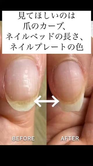 【今、話題の“自爪育成”】
当店のジェルネイルメニューには、すべて“自爪育成”の機能が備わっています。
ハンドスパ・自爪育成・ジェルネイル・ダイヤモンドネイル、すべて同時施術で受けられるのは、当店だけ！ 