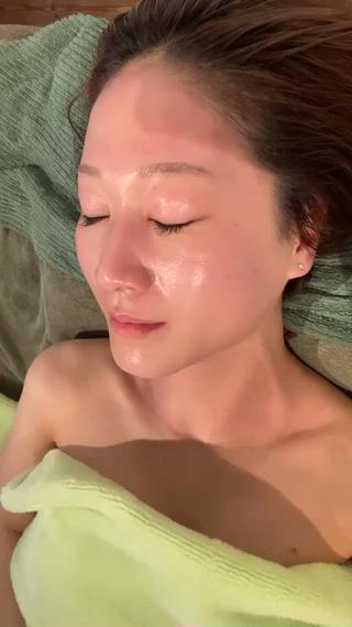 施術直後は活性してほんのりピンク色毛穴全開。いい感じです。 