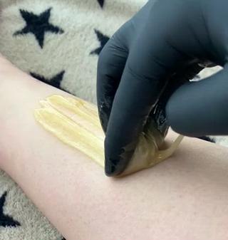 脱毛にシュガーリングいかがですか 