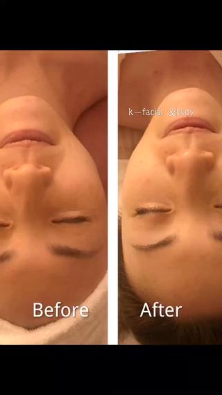 スキンケア『くすみフェイシャル』
水曜日にキャンペーン中 