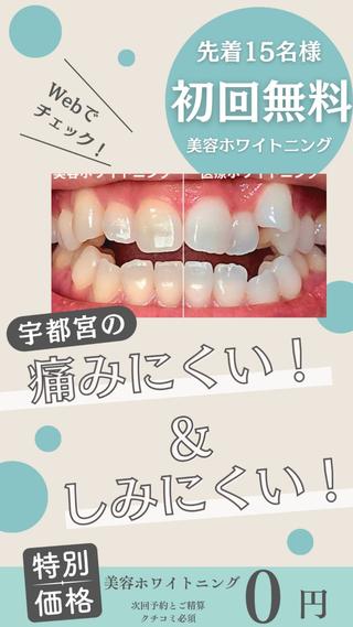 宇都宮市駒生町の歯が本当に白くなる歯科衛生士のホワイトニングサロンです️大谷街道かましん様から車で2分
マスクで隠すのもう辞めませんか?