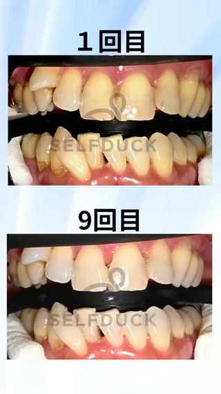 歯科提携セルフダック 宇都宮駒生店のエステ・リラクイメージ