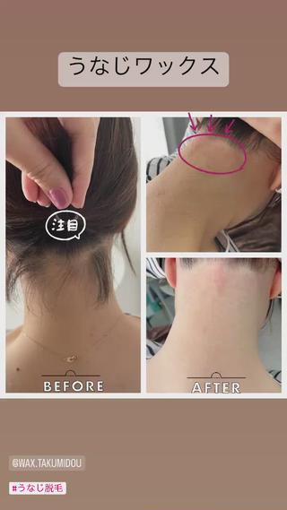 マスクに絡まるもみあげも
スッキリできますよ