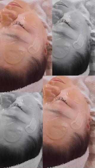 美容成分で出来た水光肌WAX！
塗って剥がしてを2回繰り返します。脱毛機でもキャッチできない小さな産毛もこの水光肌WAXは取り除いてくれます。
 