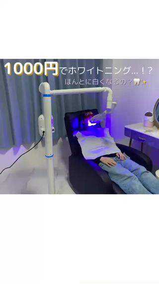 セルフホワイトニング/名古屋セルフホワイトニング/ホワイトニング名古屋/ビフォーアフター/初回1000円 