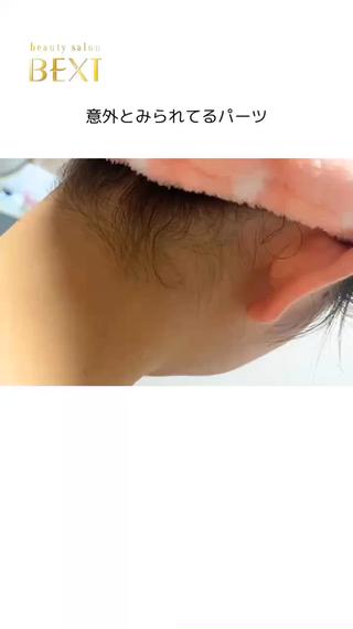 うなじ脱毛ビフォーアフター
初回1100円★
#うなじ脱毛名古屋#脱毛名古屋#全身脱毛名古屋#メンズ脱毛名古屋#レディース脱毛名古屋 