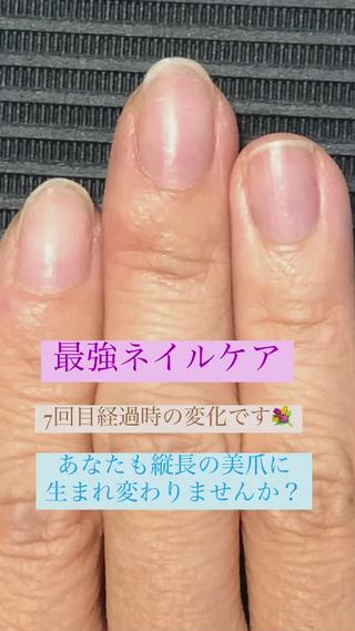 自爪育成「最強ネイルケア」 