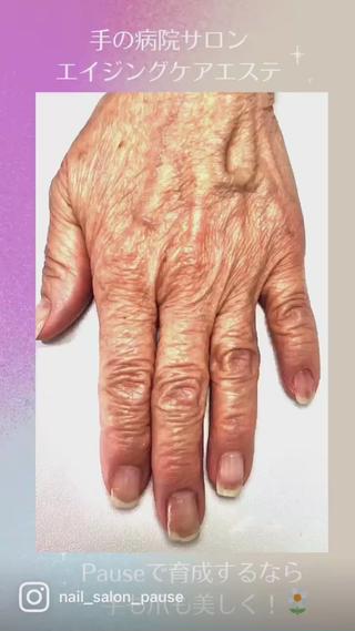 マシン使用のエイジングケアハンドエステ、「手の病院サロン」美容成分を肌の奥まで浸透させ、シミ・シワ・たるみ・くすみにアプローチします 