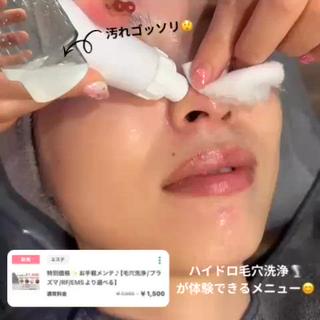 普段落としきれていないお顔の汚れを
2剤のピーリング剤でしっかりアプローチ

ご体験はなんと、、、1500円
選べる機器で小顔効果が期待できる機器も
選択可能です♪ 