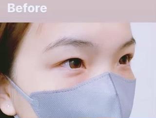 ハリウッドブロウリフト+上下ラッシュリフト
¥11000(税込) 初回所要時間:2時間 