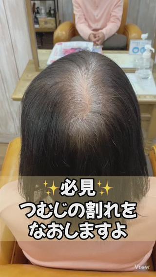 特許技術 エンジェリックケアの効果
つむじや前髪の割れを解消します！ 