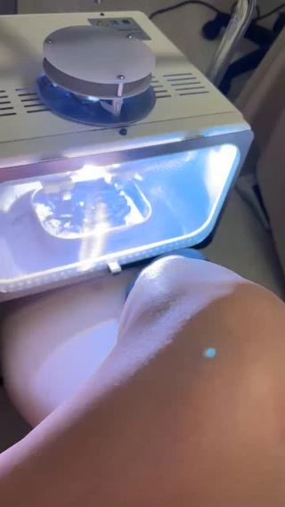 ふくらはぎが激痛でしたが、MRIで腰痛から来る神経痛となりふくらはぎと腰を照射 