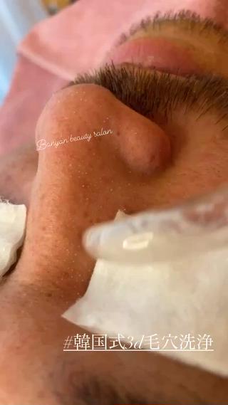 韓国式3D毛穴洗浄

男性にも人気です

鼻、頬、おでこ、あご、一回で全顔対応します 