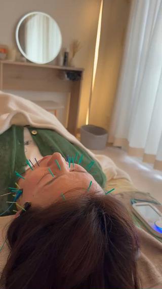 美容鍼では電気を流して
コリ固まったお顔の筋肉を
しっかりほぐします

たるみが引き締まってくれます 
