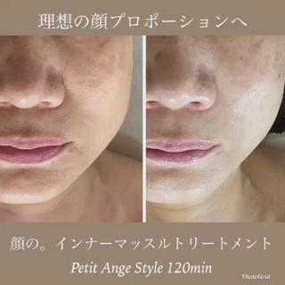 プチアンジェ所属・艶肌&小顔リフト❤︎ プチアンジェ茅ヶ崎のエステ・リラクイメージ