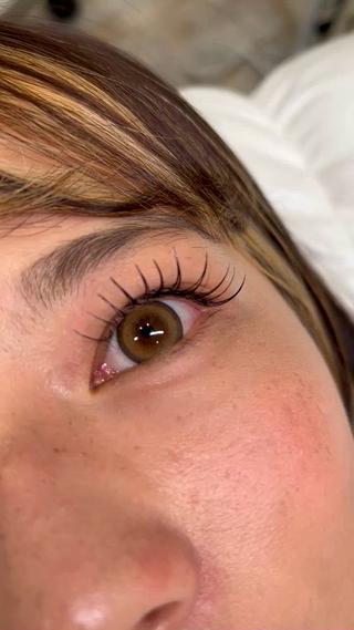 BL(バインドロック)