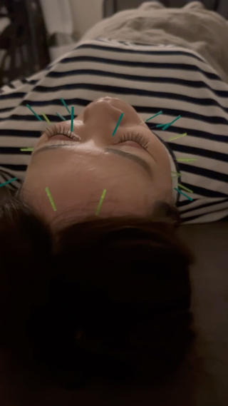 美容鍼×小顔矯正 ×美容整体　浜川泰仁のエステ・リラクイメージ