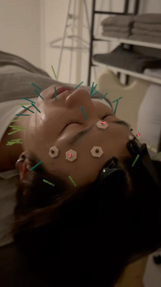 美容鍼×小顔矯正 ×美容整体　浜川泰仁のエステ・リラクイメージ