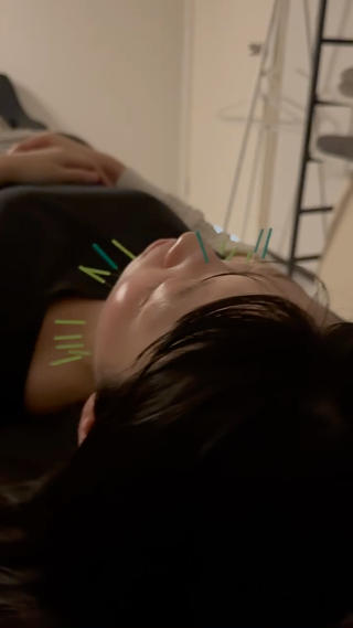 美容鍼×小顔矯正 ×美容整体　浜川泰仁のエステ・リラクイメージ