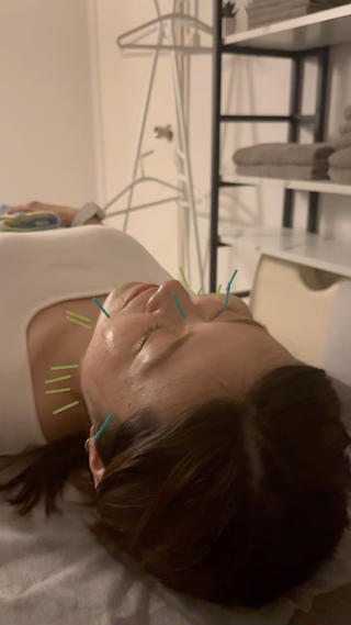 美容鍼×小顔矯正 ×美容整体　浜川泰仁のエステ・リラクイメージ