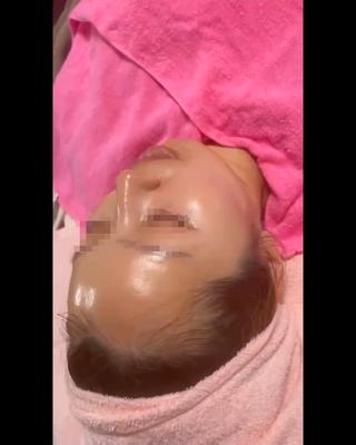 ララピール施術直後に効果実感️
艶ピカ肌目指しませんか？ 