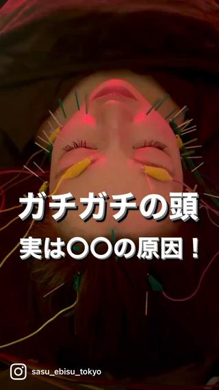 セミロング カラー パーマ ヘアアレンジ メンズ キッズ ネイル マツエク・マツパ アイブロウ 即小顔♥️美容鍼× ハーブピーリングのその他イメージ