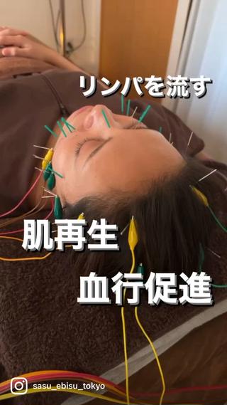 ショート カラー パーマ ヘアアレンジ メンズ キッズ ネイル マツエク・マツパ アイブロウ 即小顔♥️美容鍼× ハーブピーリングのその他イメージ