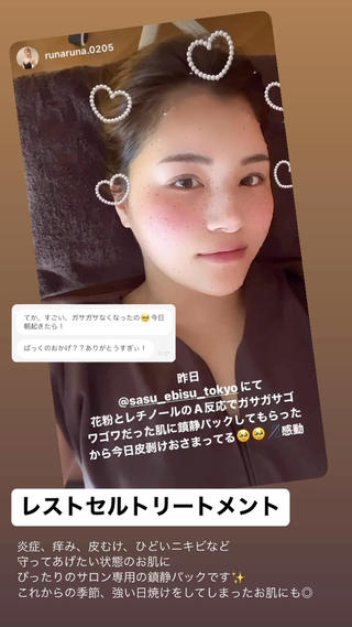 ロング カラー パーマ ヘアアレンジ メンズ キッズ ネイル マツエク・マツパ アイブロウ 即小顔♥️美容鍼× ハーブピーリングのその他イメージ